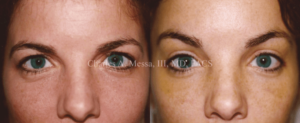 Dr. Charles Messa - Plastic Surgery Treatments to Make You More Youthful