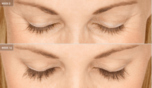 Dr. Charles Messa - Latisse® For Longer Lashes